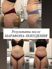Марафон похудения